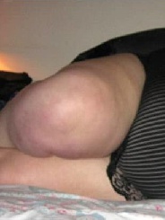 dicke_Loren aus Steinau an der Straße